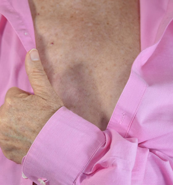 Breast type: μειώσετε τον κίνδυνο για καρκίνο του μαστού